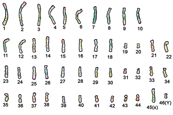 Chromosomes ordered but number 46 changes whether it is male or female